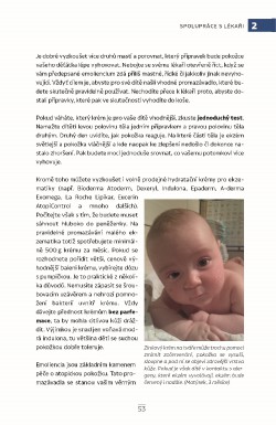 atopicky-ekzem_2.jpg